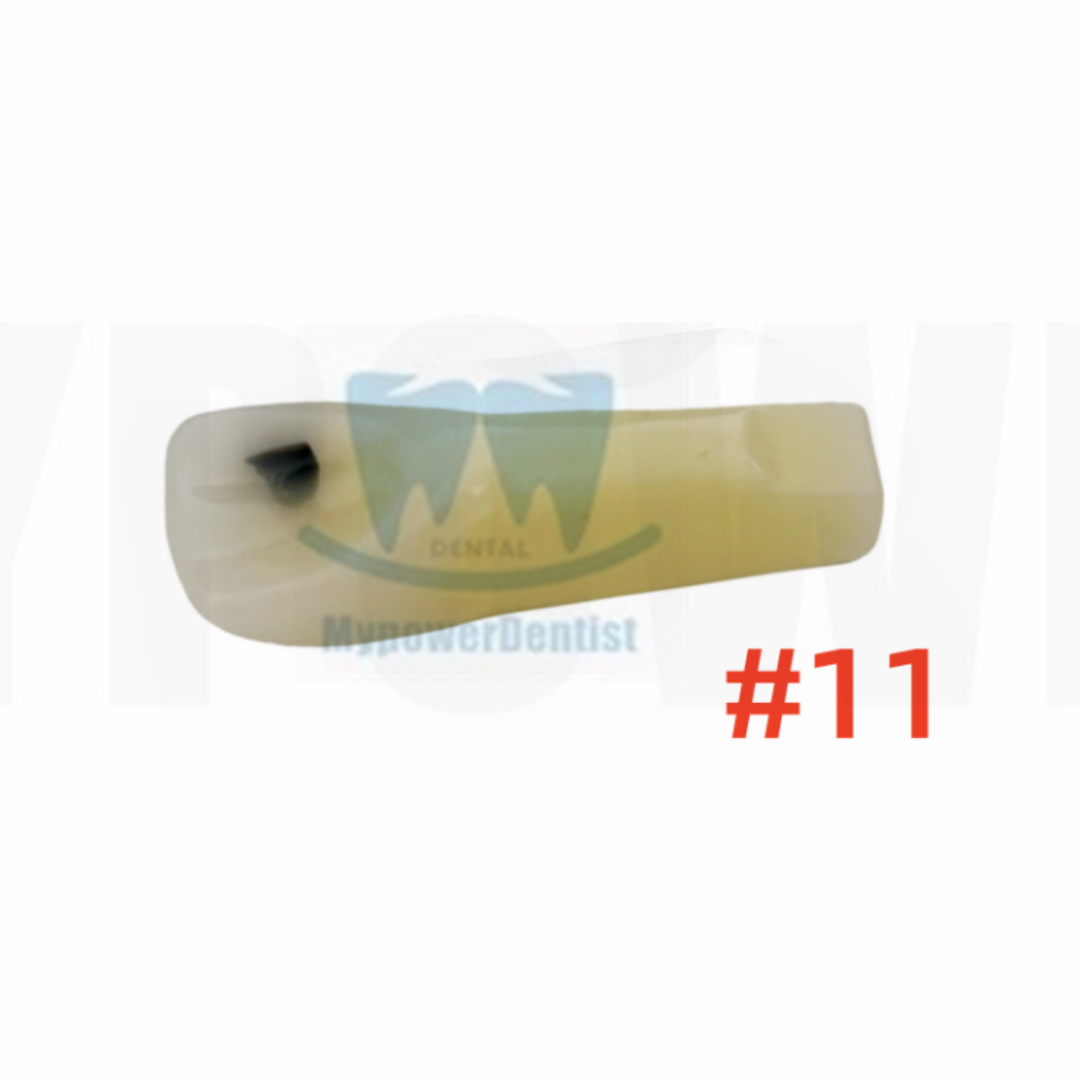 Dental Vitro Teeth Decay Caries Screw Model Dentist Tooth Teach Tool #11 #36 - Picture 14 of 15
