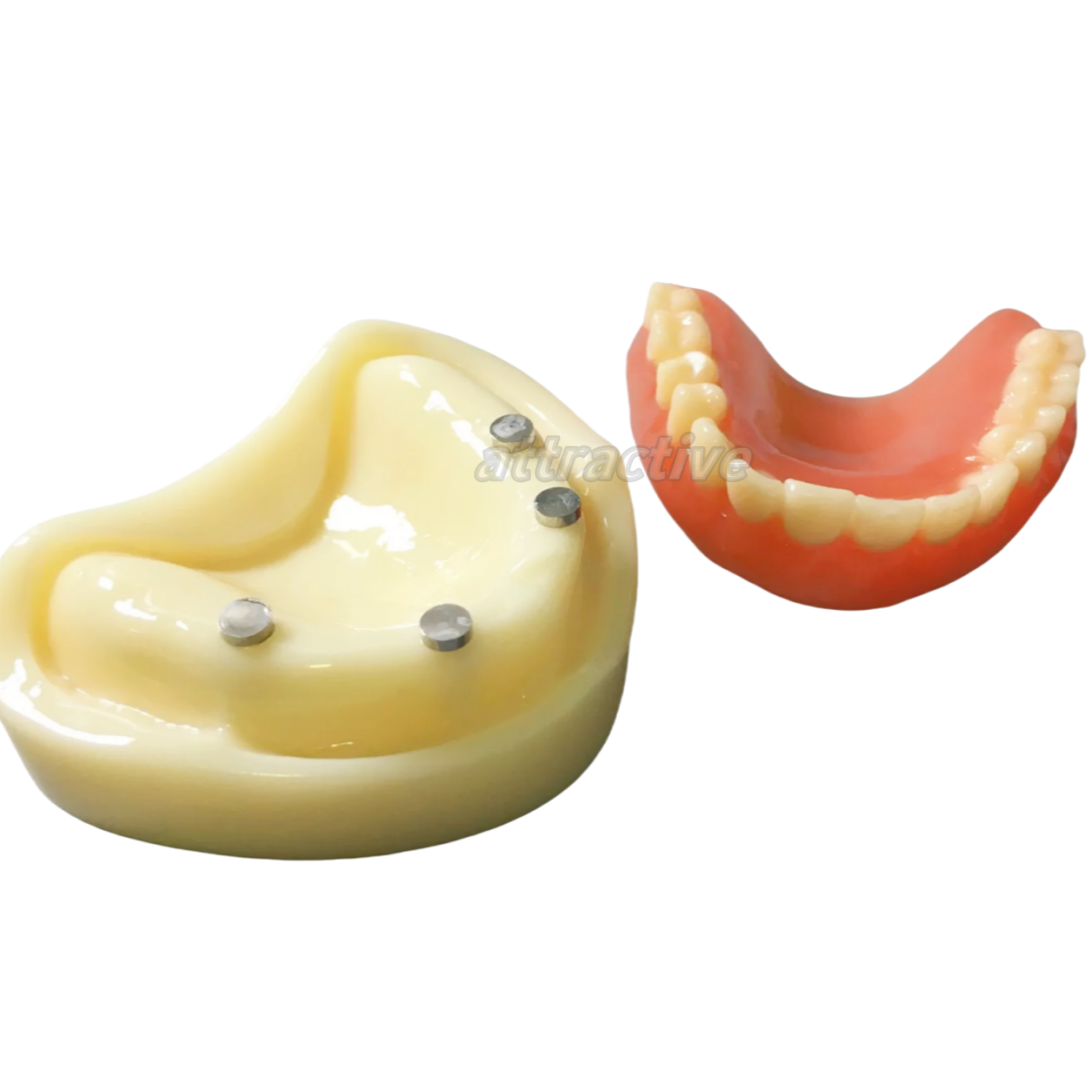 Dental Full Denture Study Model Magnetic Attachment Mandibular Upper/Lower