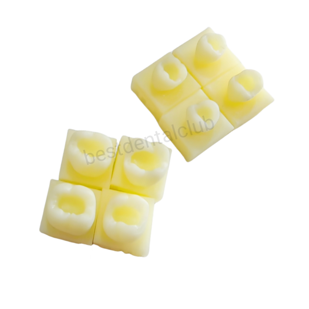 1Set Dental Molar Caries Decay Teeth Model Composite Resin Restore Tooth Simulat