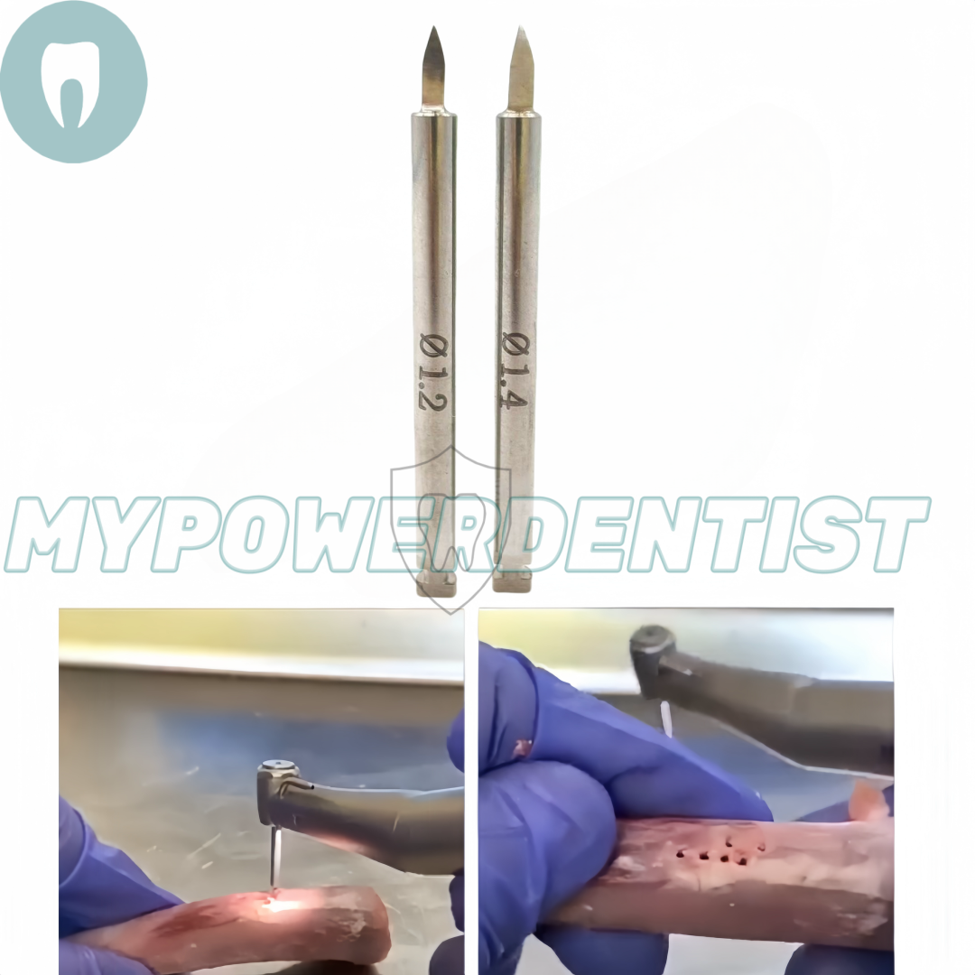 Dental Pilot/Nutrient Drill Bone Screw GBR Tent Screws Insertion Tacks Socket