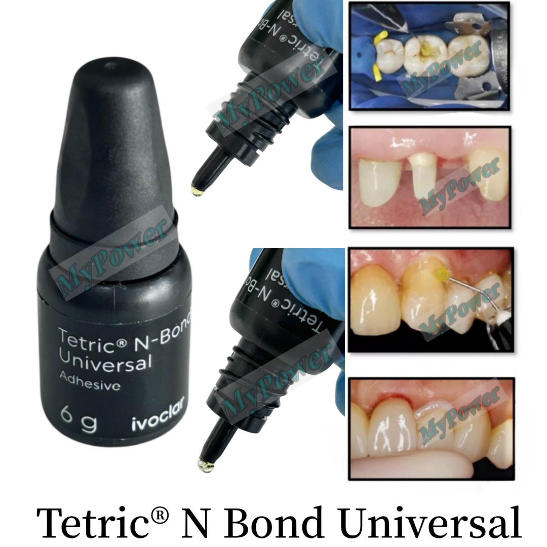 Ivoclar Tetric N-Bond Dental Universal Viva-Pen Universal Bonding Agent - Bild 11 von 11