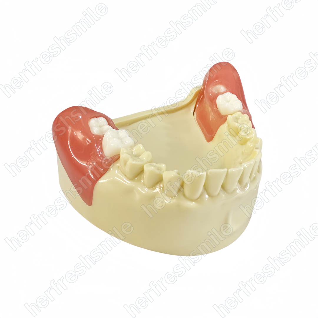 Dental Obstructed Wisdom Teeth Extraction Model Lower Soft Gingiva Study Model