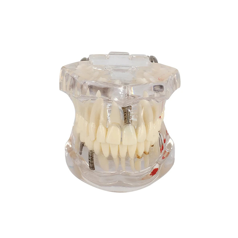 Dental Disease Teeth Model Tooth Demonstration Model for Dental Research Study