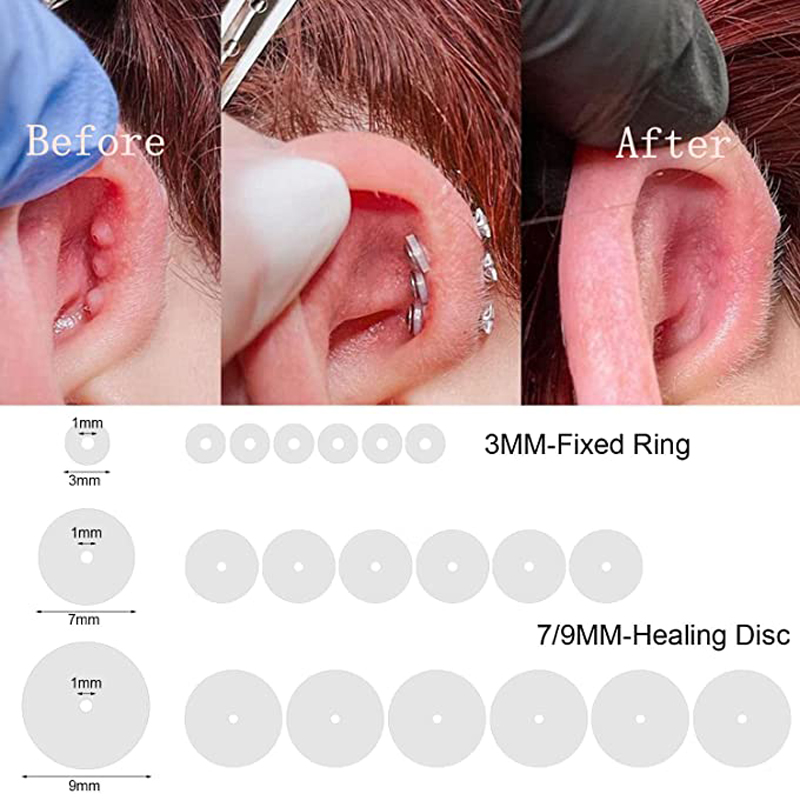 20pcs No Pull Piercing Discs - Silicone Earring Backs For Comfort & Hyperplasia Prevention