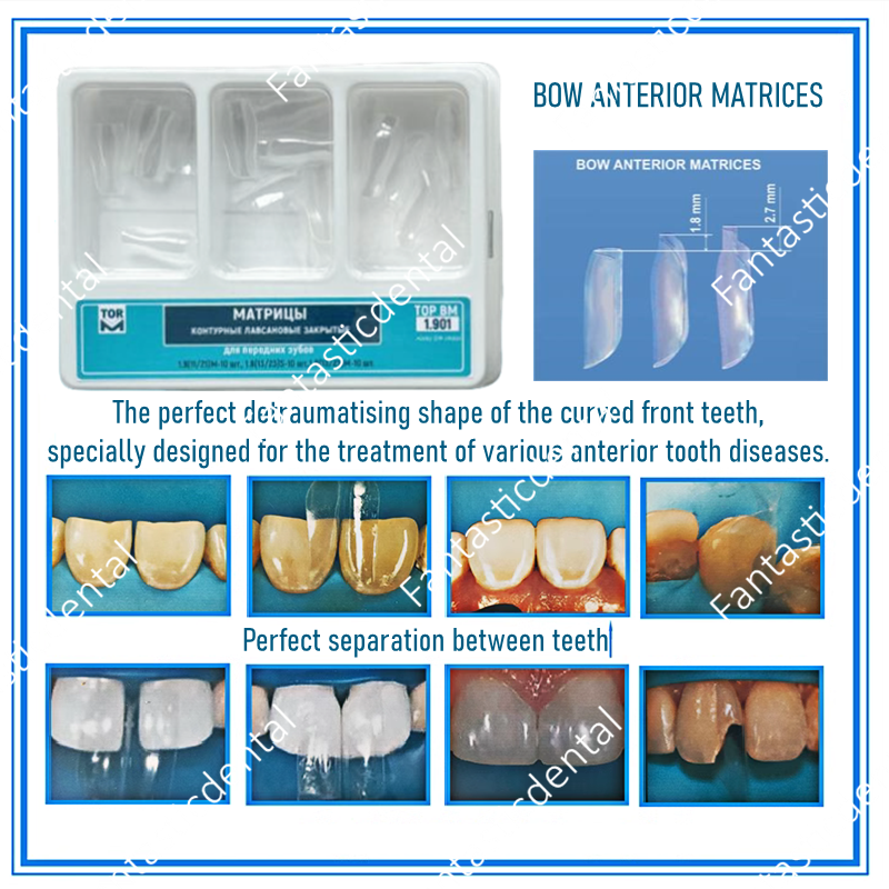 Kit De Matrices Dentaires Transparentes Bioclear - Modèles Antérieurs, Avec Arc, Tailles L/M/S