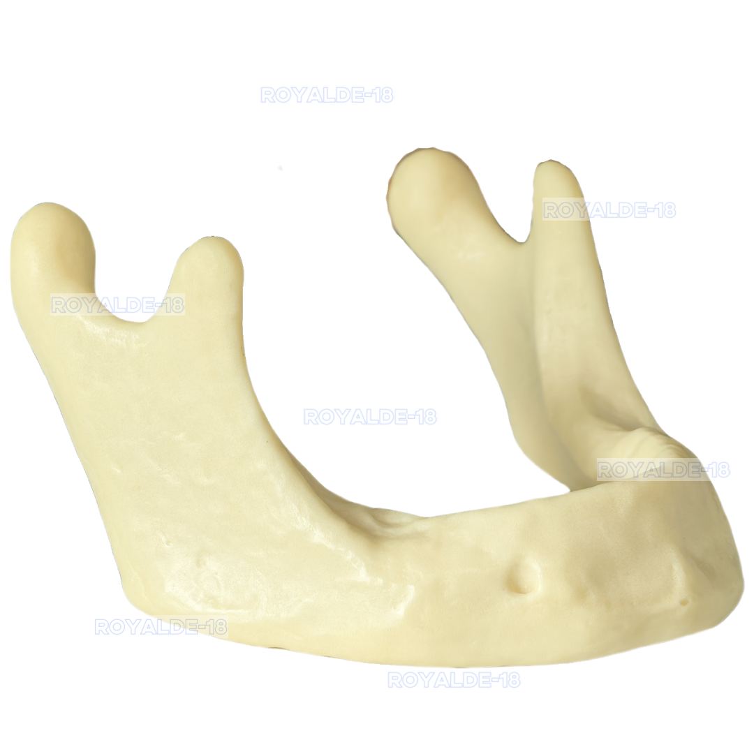 Implante Dental SLT Media Luna Hueso Taladro Mandíbula Modelo Para Extraer Hueso en Escamas - Imagen 19 de 19